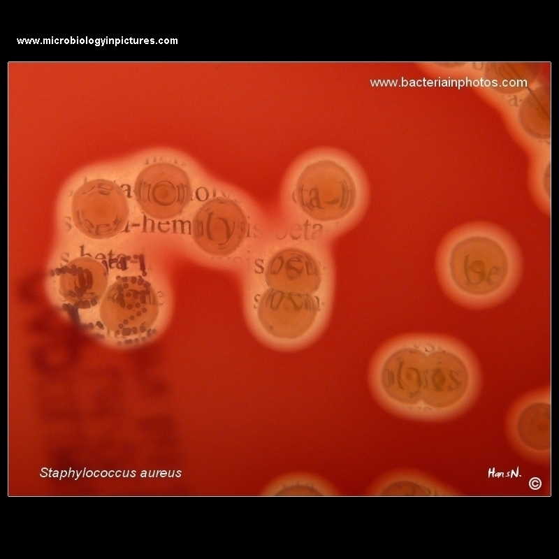 Staphylococcus aureus colonies with beta hemolysis