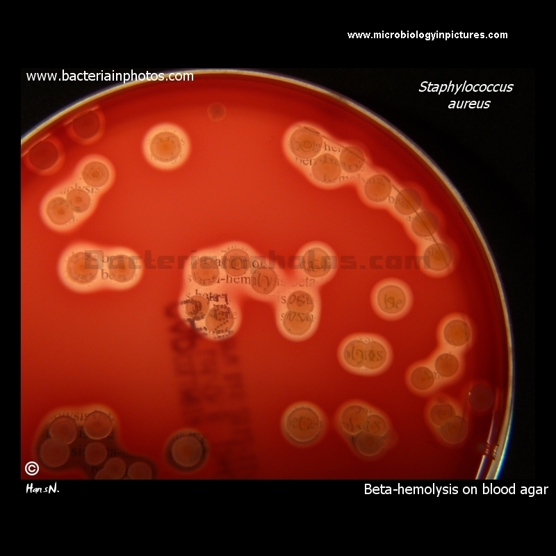 Staphylococcus aureus beta-hemolysis on blood agar