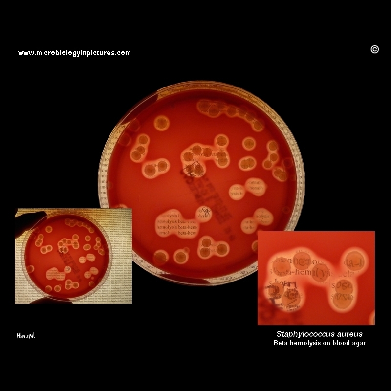 Beta-heemolysis,Staphylococcus aureus