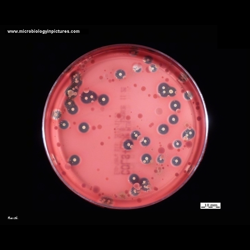 beta hemolysis