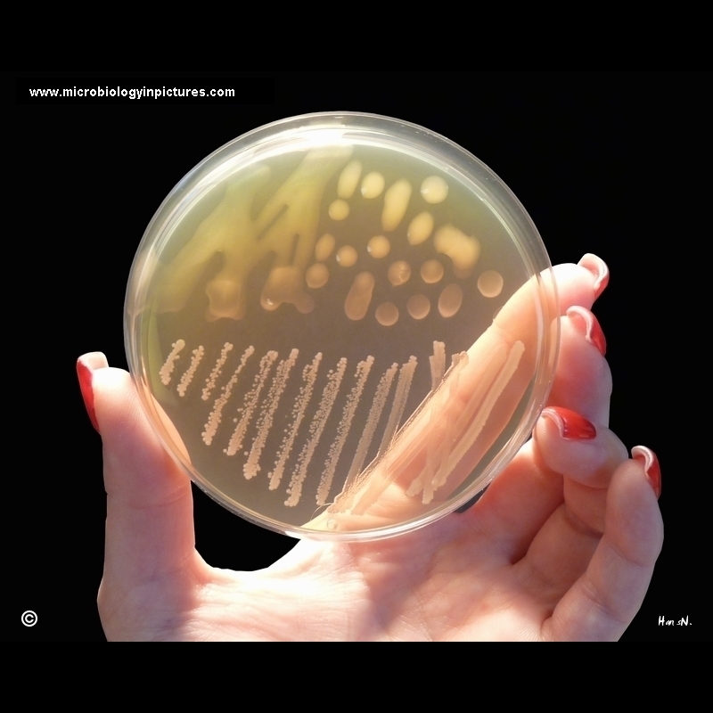 streptococcus equi ssp. zooepidemicus and streptococcus agalactiae 