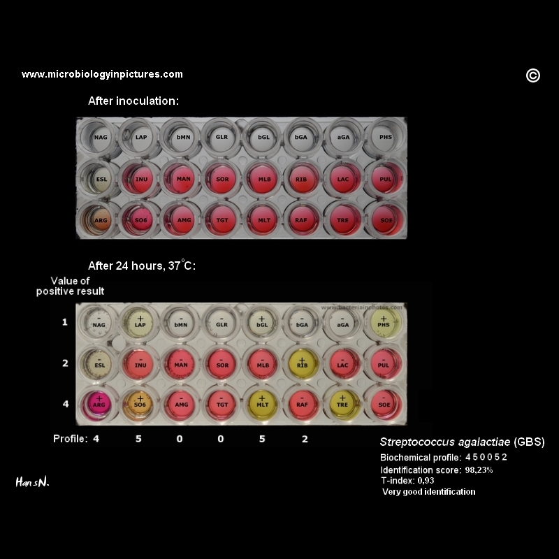 biochemical tests for strep agalactiae