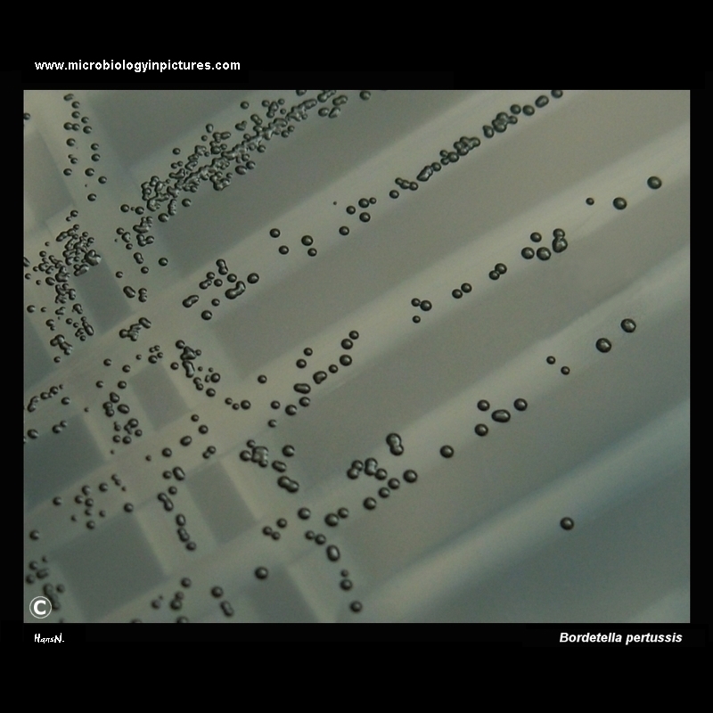 Bordetella pertussis on charcoal agar