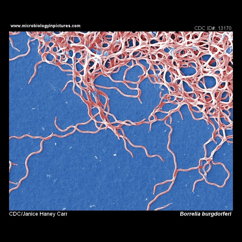 borrelia image