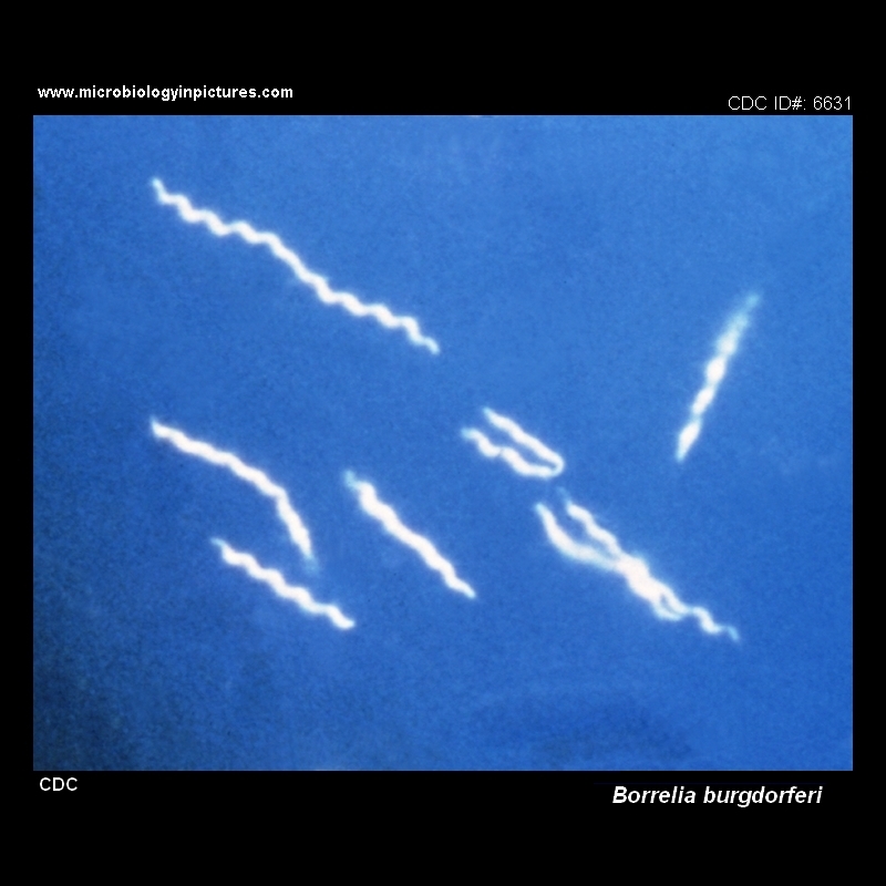 borrelia darkfield microscopy