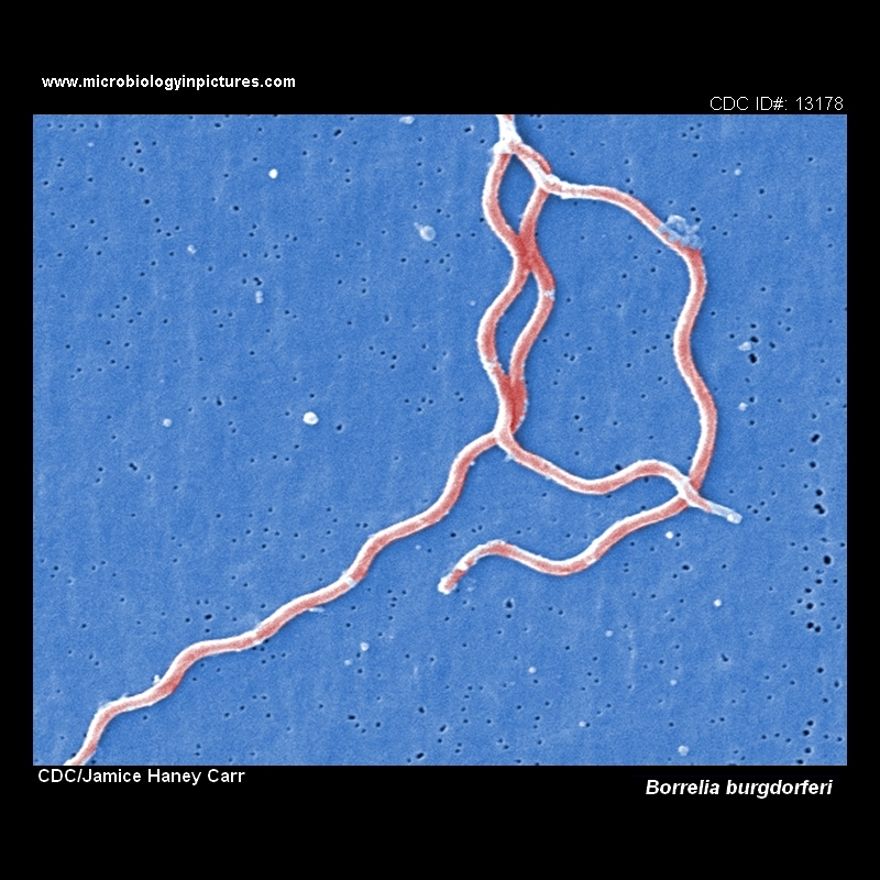 borrelia