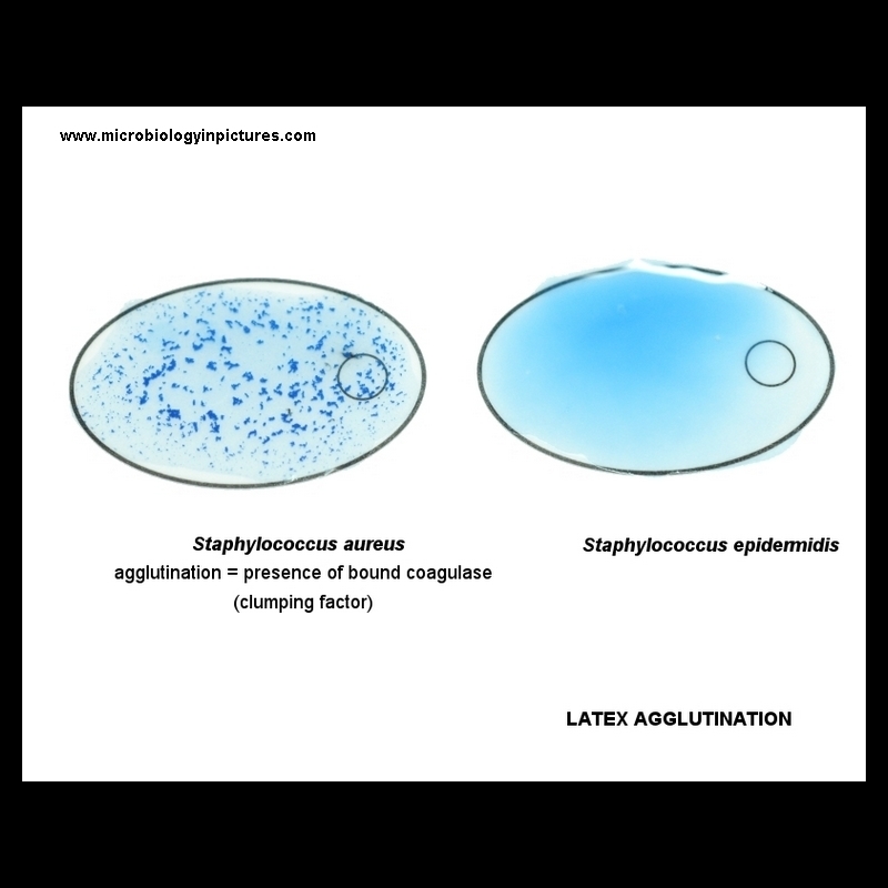 bound coagulase, latex agglutination