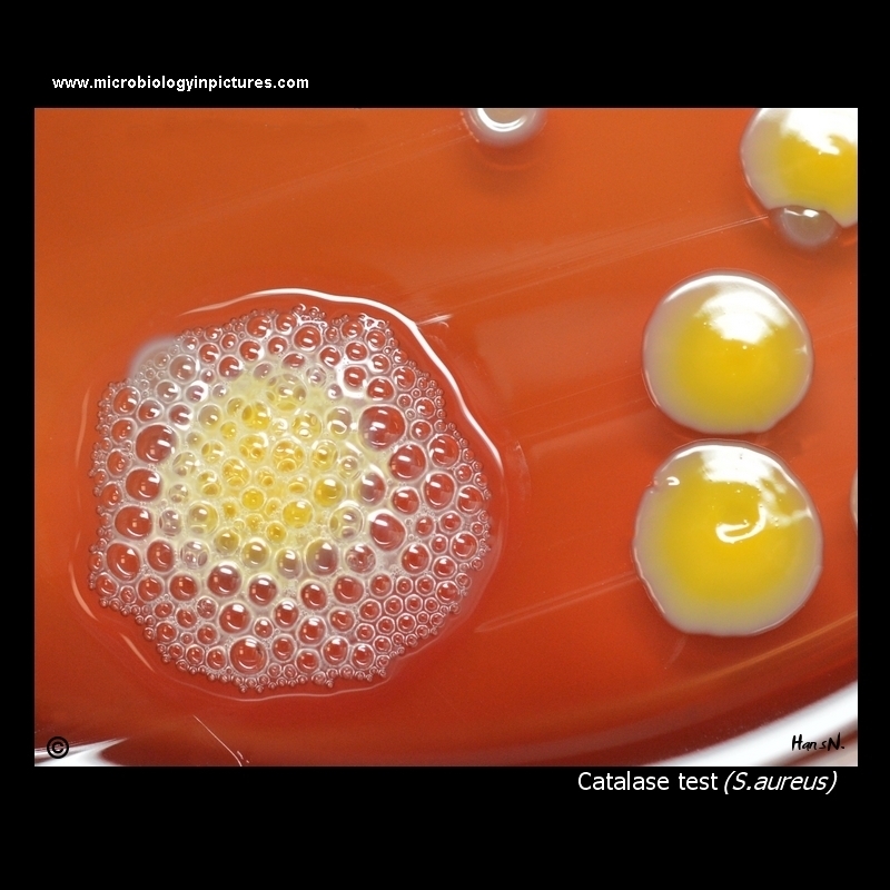 positive catalase test