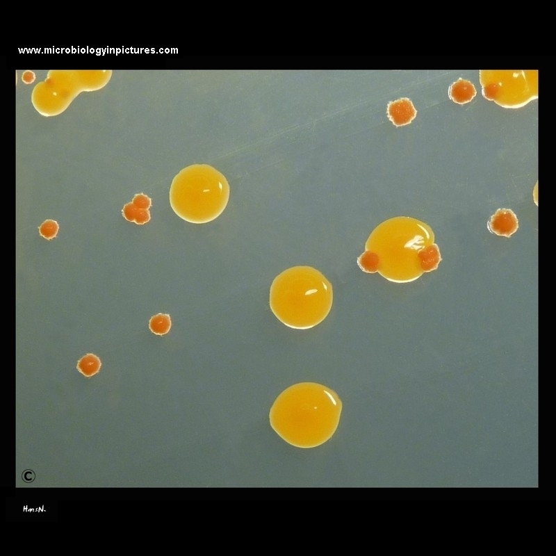 Chryseobacterium indologenes and actinomycete colonies on Mueller-Hinton agar
