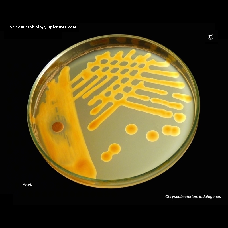 Chryseobacterium indologenes colonies on Mueller-Hinton agar