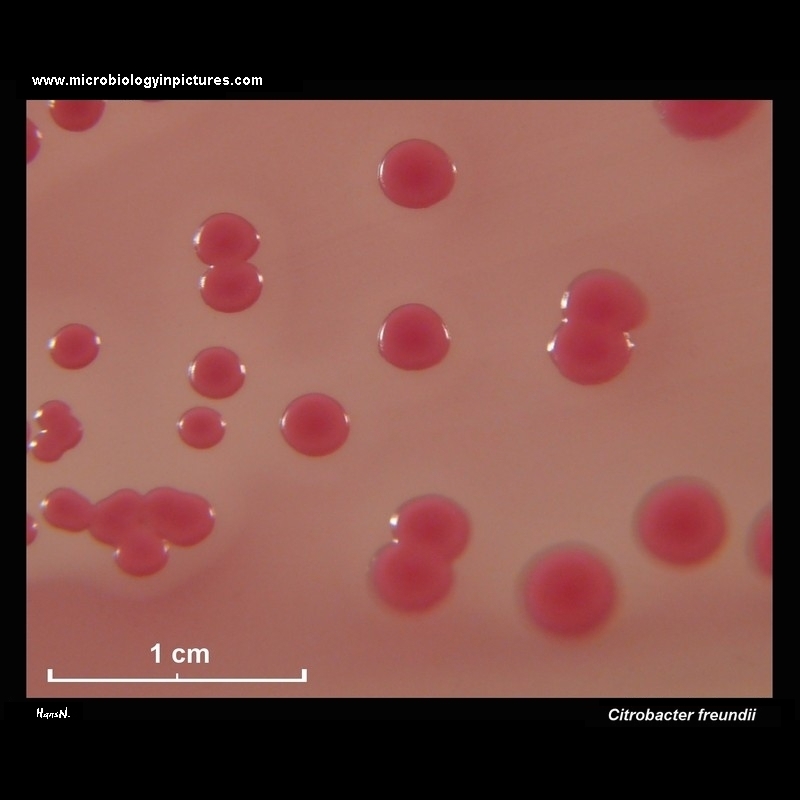 Citrobacter freundii colonies on MacConkey agar