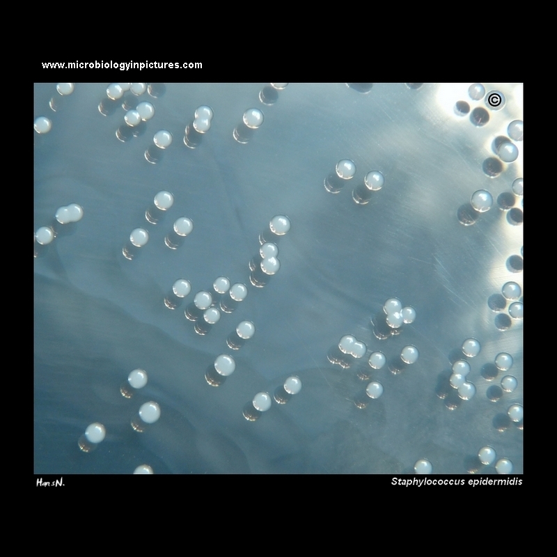 coagulase negative s.epidermidis