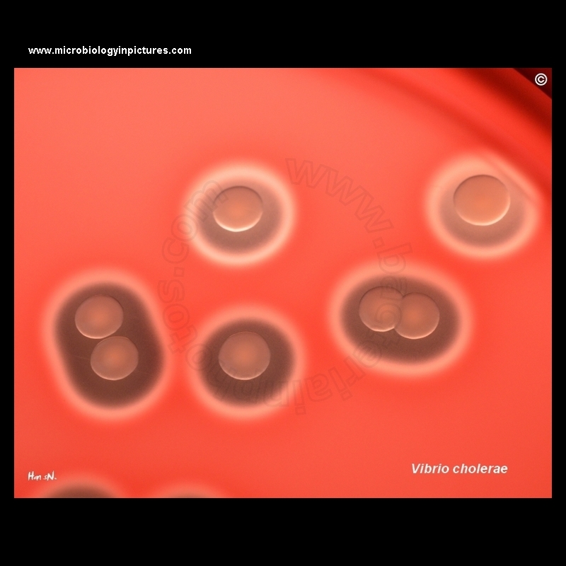 vibrio cholerae colonies