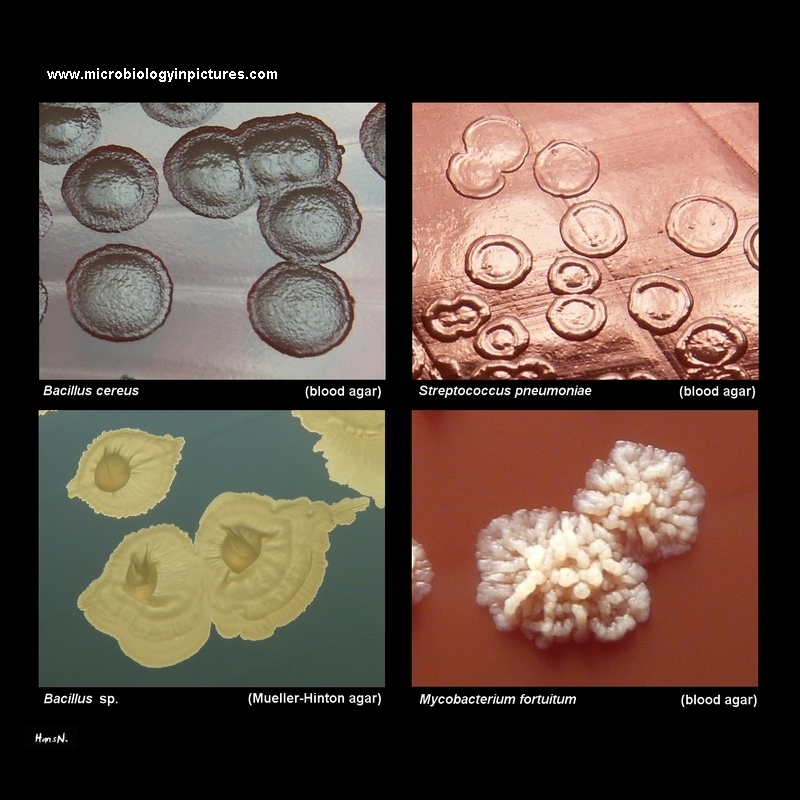 colony morphology