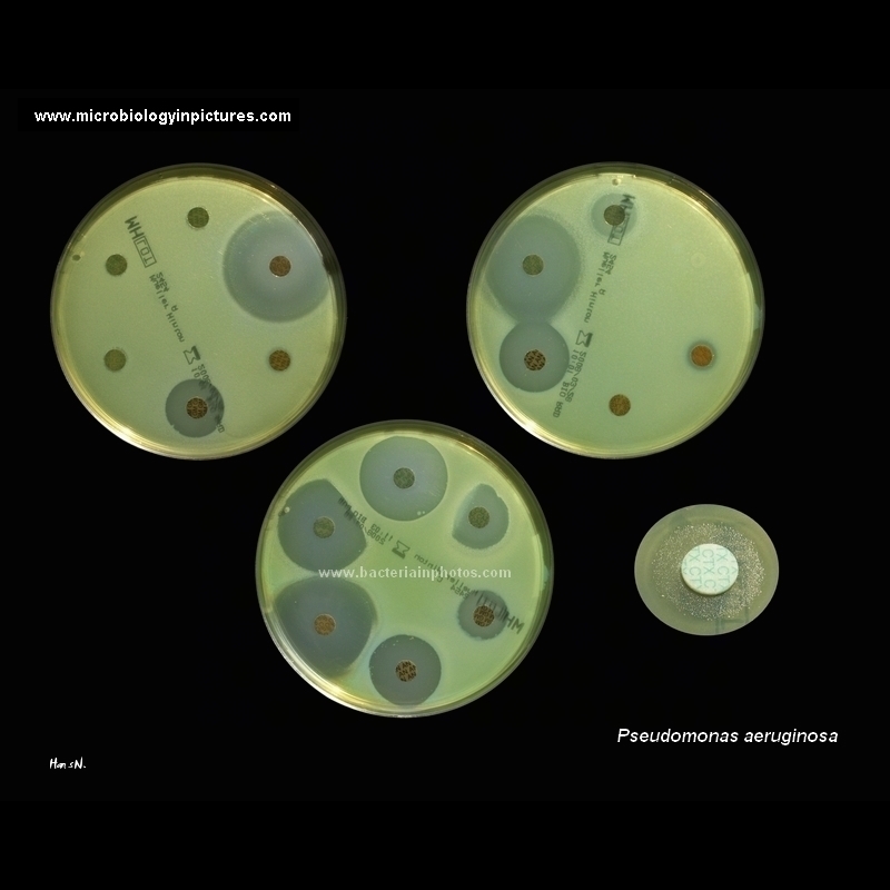 antibiotic testing by diffusion test