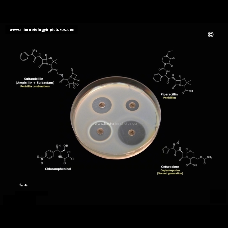 antibiotic testing disc diffusion method