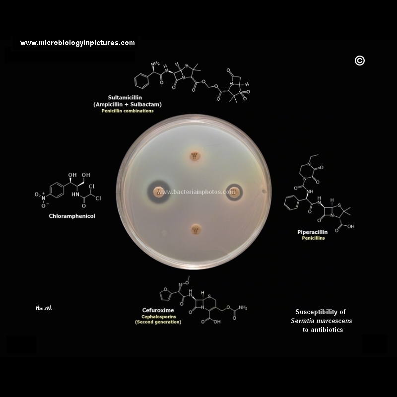 antibiotic testing: antibiotic resistance