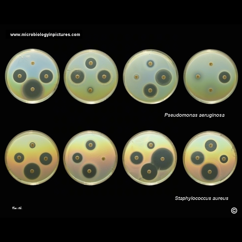 antibiotic susceptibility testing by diffusion test