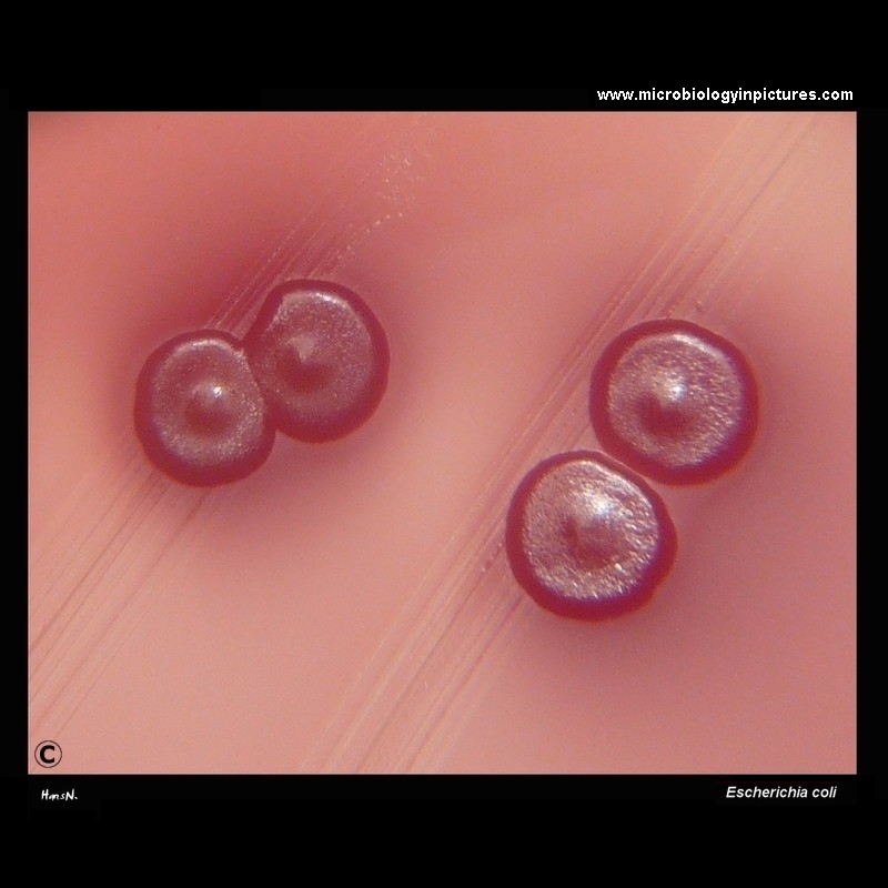 Escherichia coli lactose positive colonies on MacConkey agar, E.coli colonies