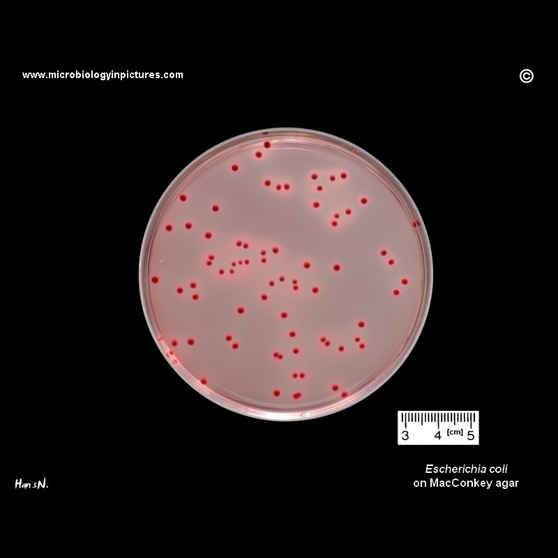 Escherichia coli on MacConkey agar