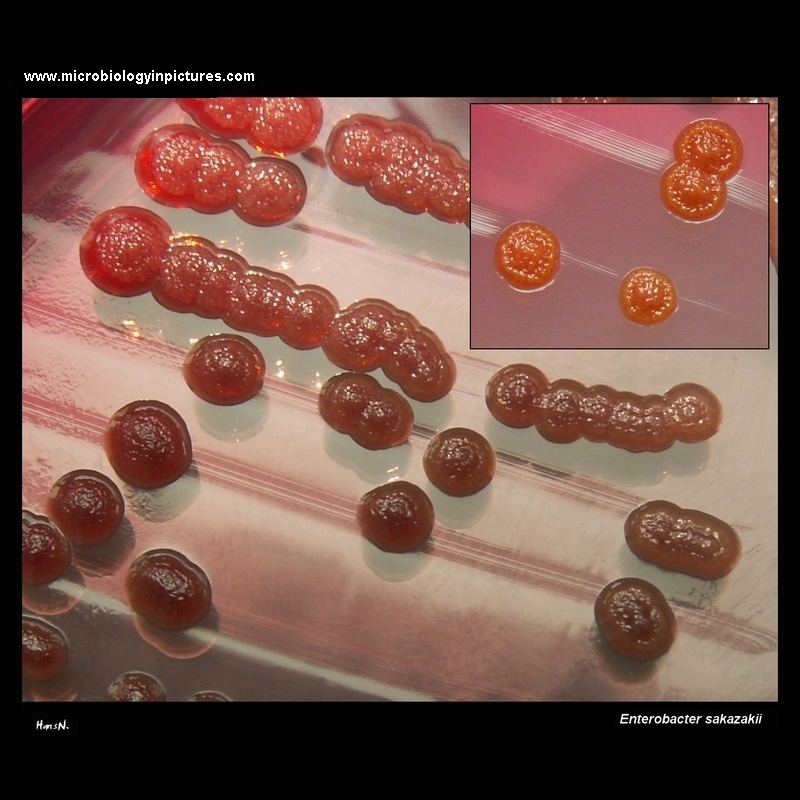 Enterobacter sakazakii, Cronobacter sakazakii