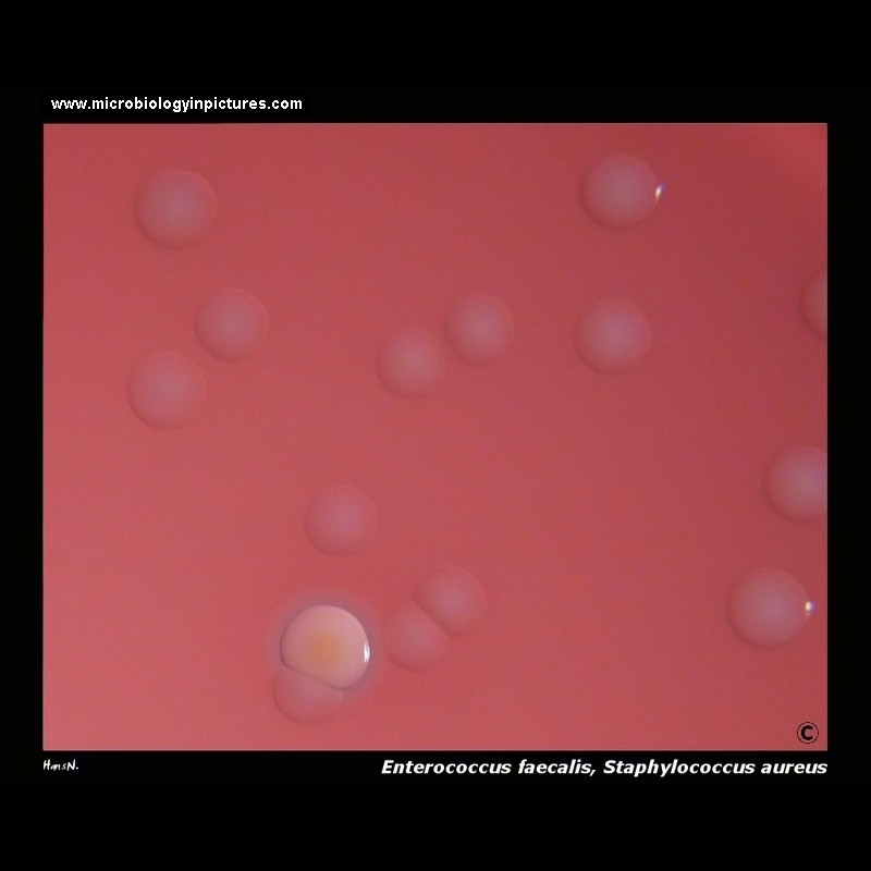 gamma hemolysis on blood agar