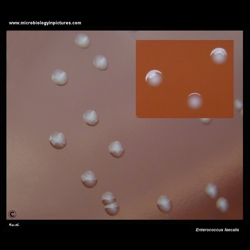Enterococcus faecalis colonies on blood agar