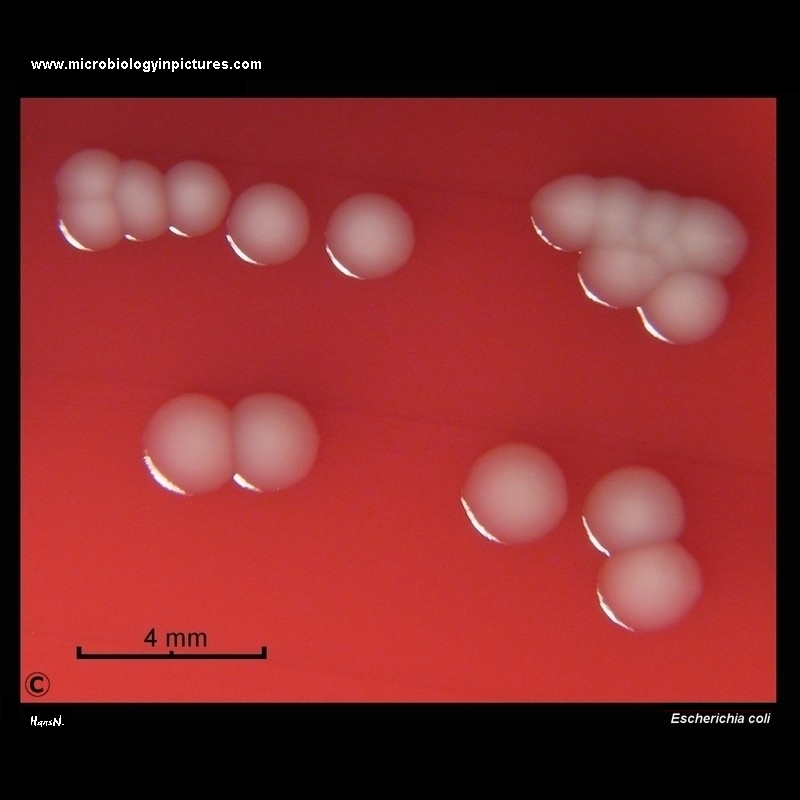 Escherichia coli colonies on blood agar, E.coli colonies