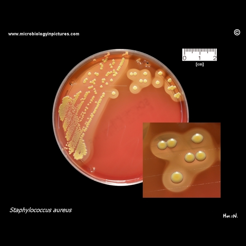 Staphylococcus aureus on Schaedler agar