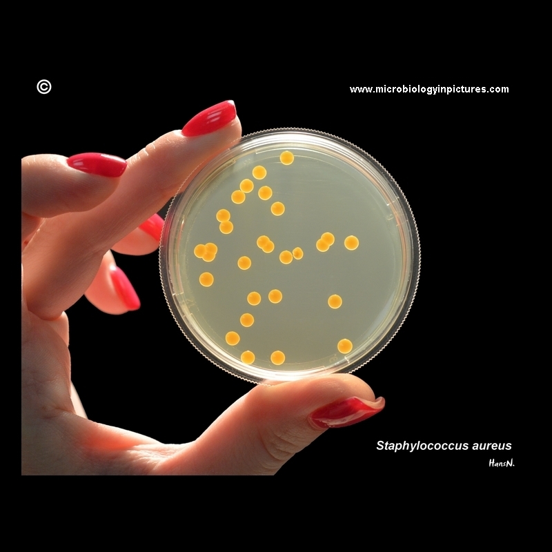 A hand holding S.aureus