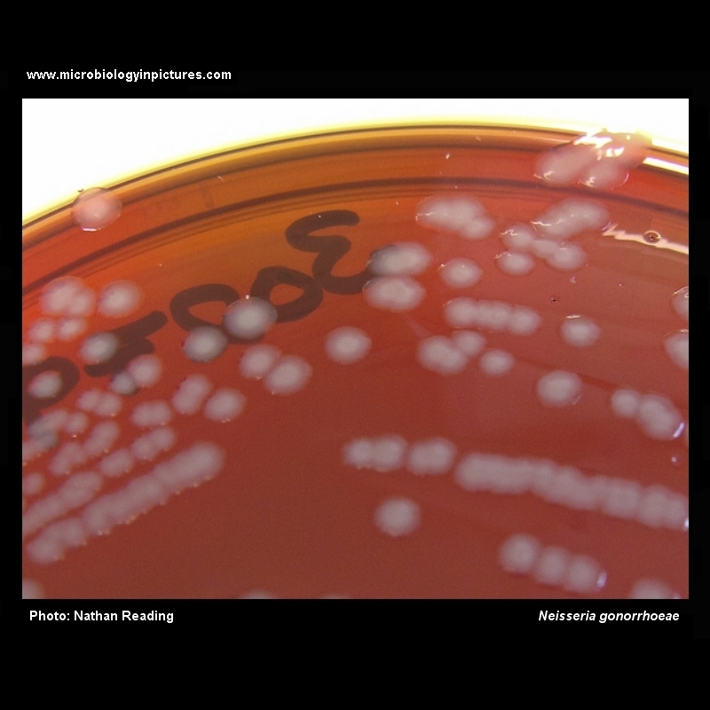 Neisseria gonorrhoeae on New York City Agar