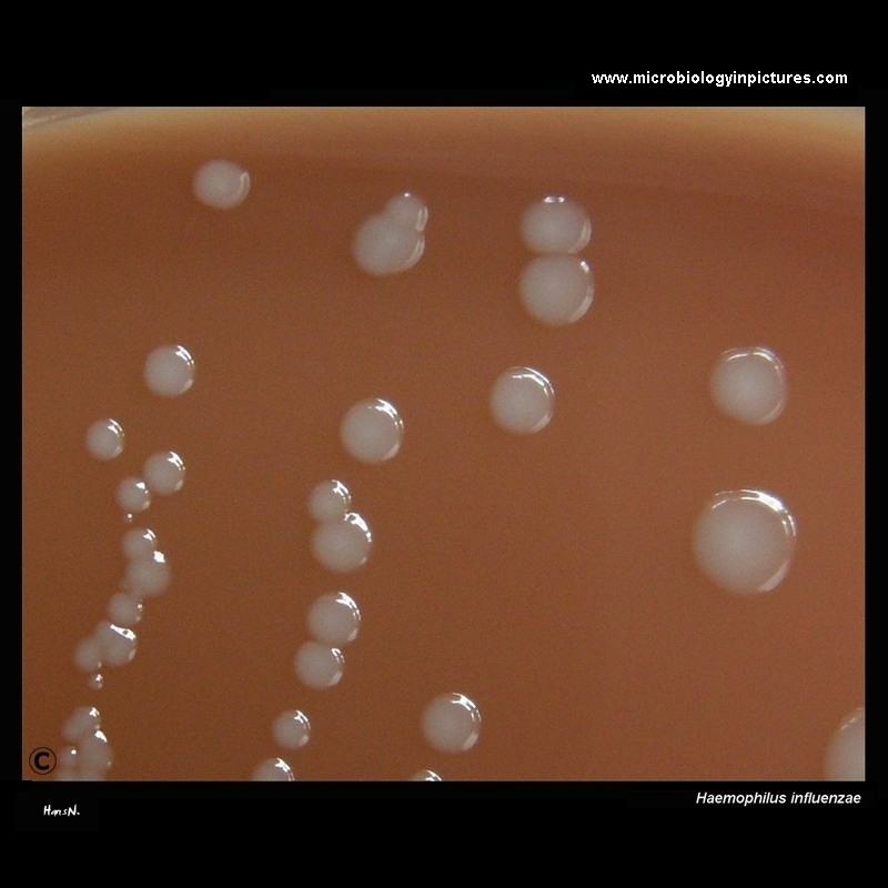 Haemophilus influenzae colonies on chocolate agar