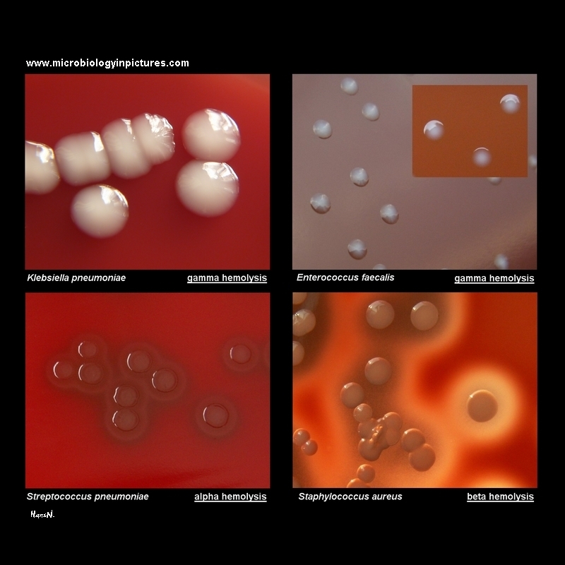 colonies of bacteria and hemolysis