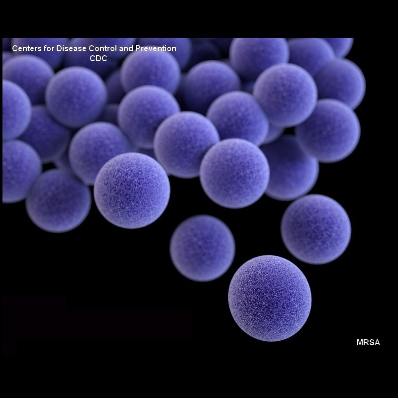 MRSA 3D