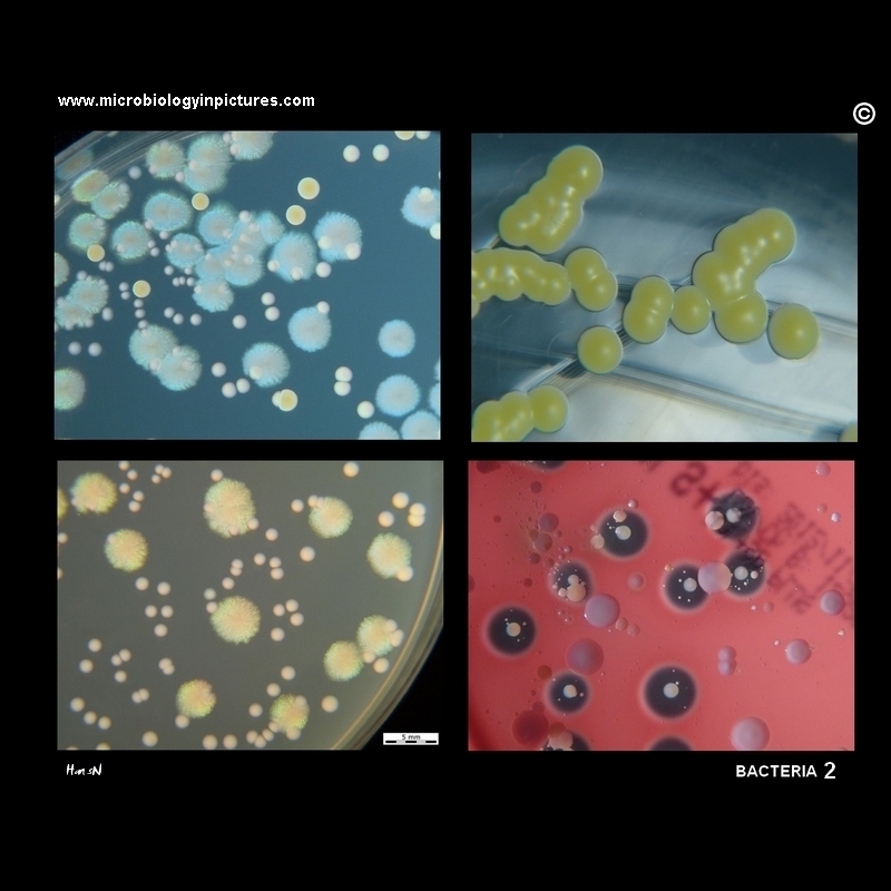 images of bacteria with description