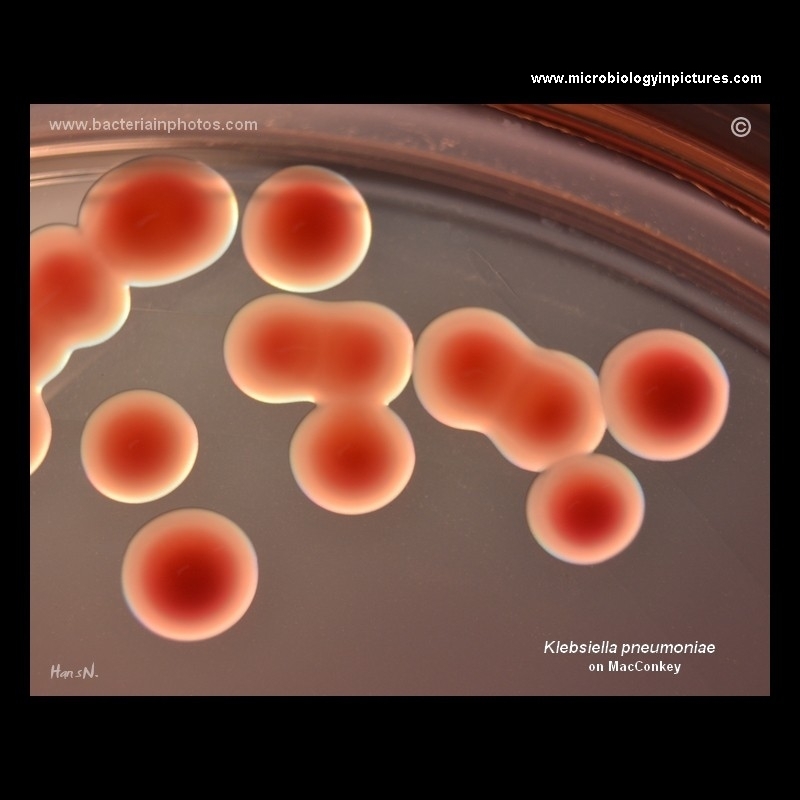 K.pneumoniae colonies