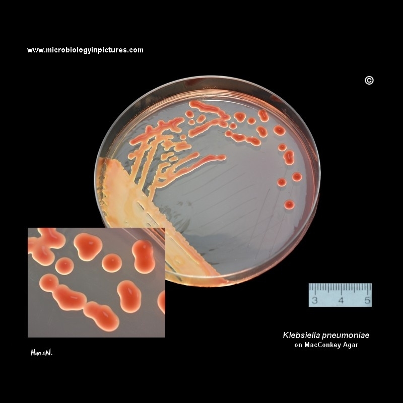 Klebsiella pneumoniae on MacConkey