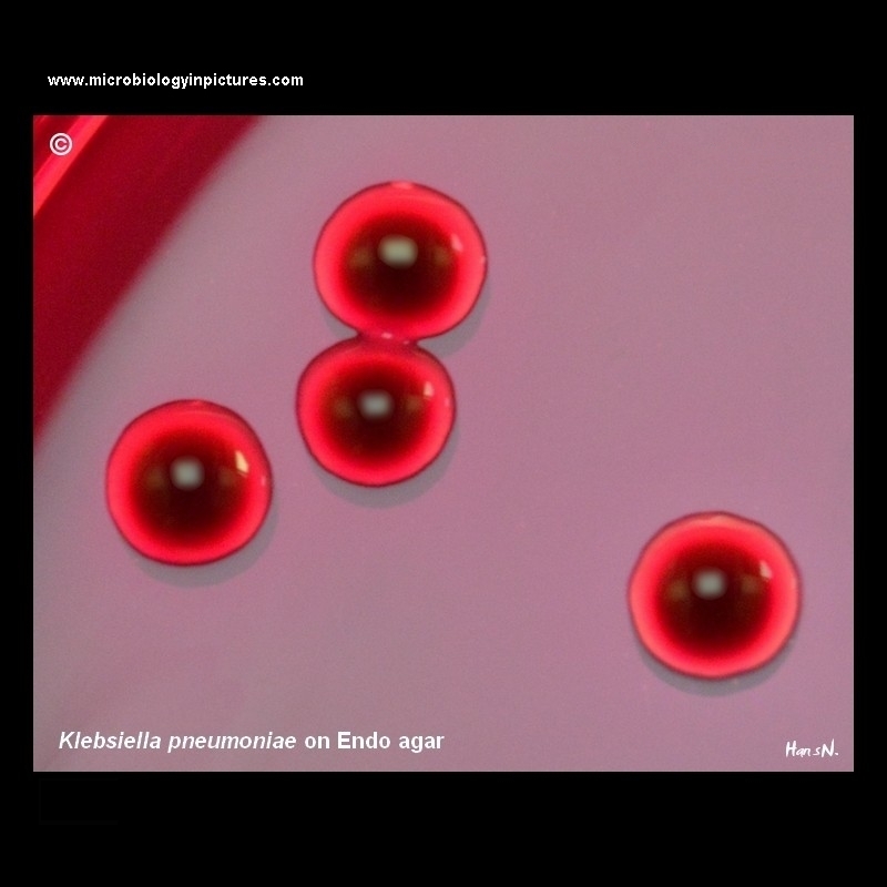 Klebsiella pneumoniae on Endo