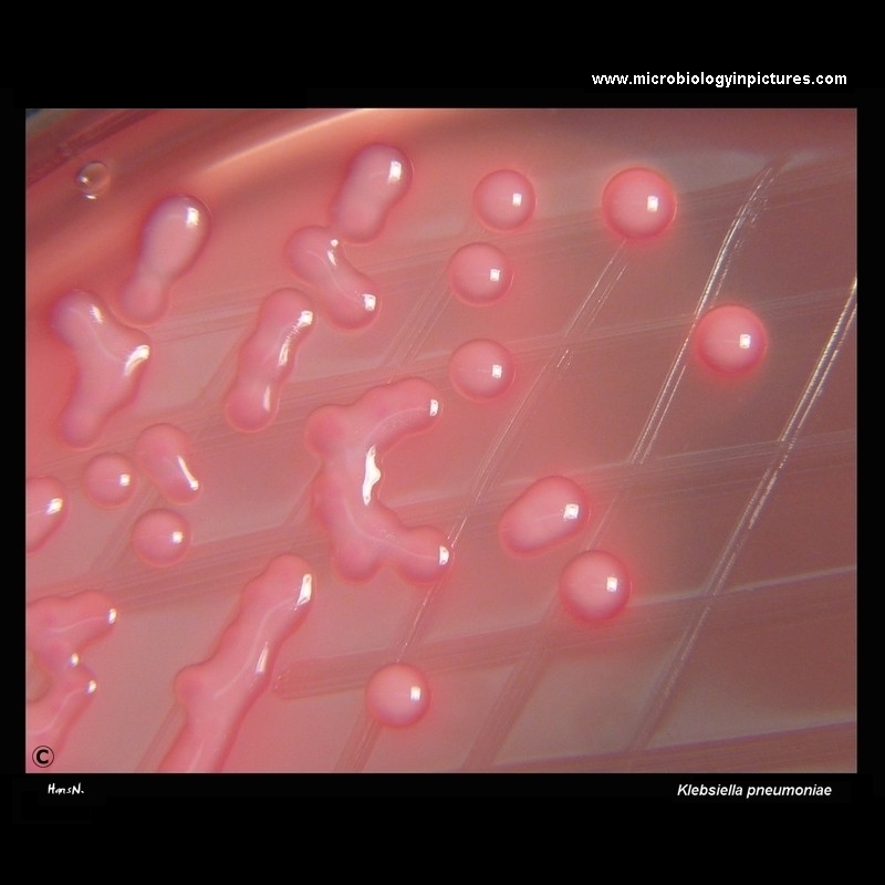 Klebsiella pneumoniae on MacConkey agar