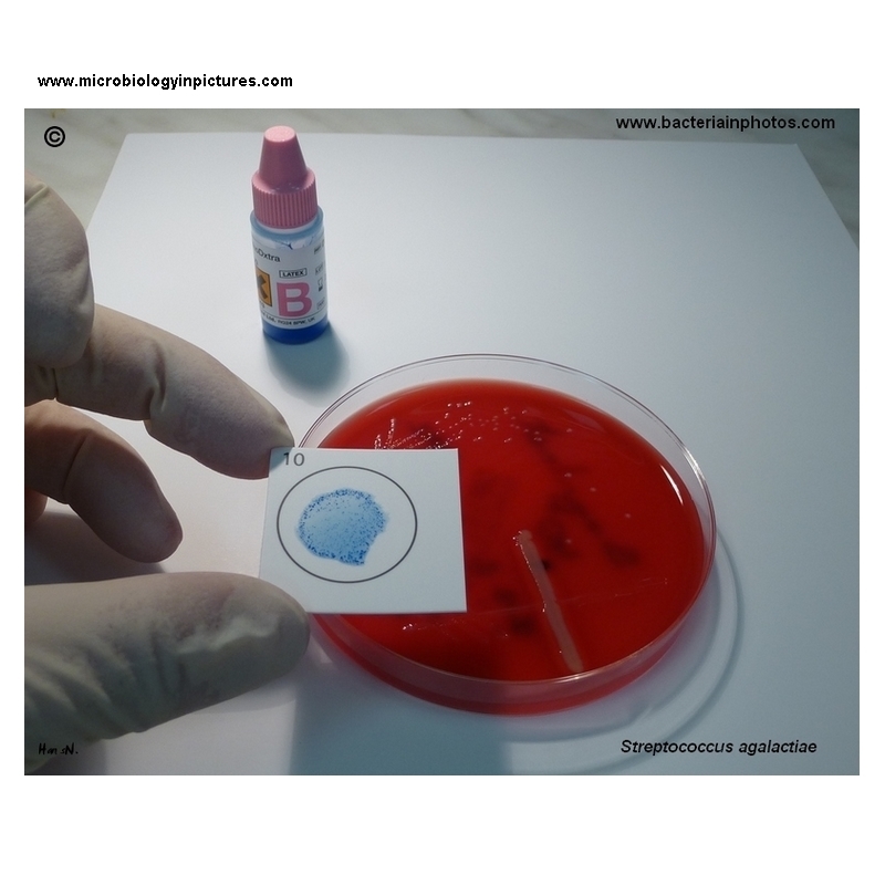 latex agglutination of GBS