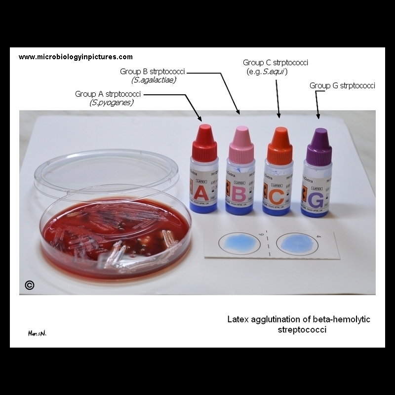 latex aglutination of streptococci