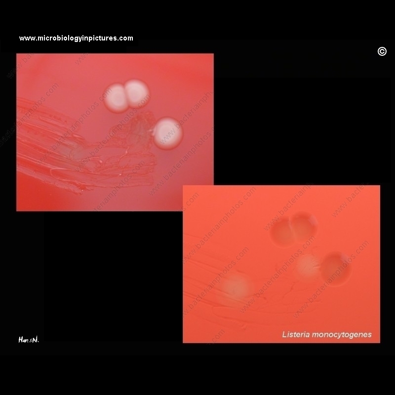 Listeria monocytogenes hemolysis