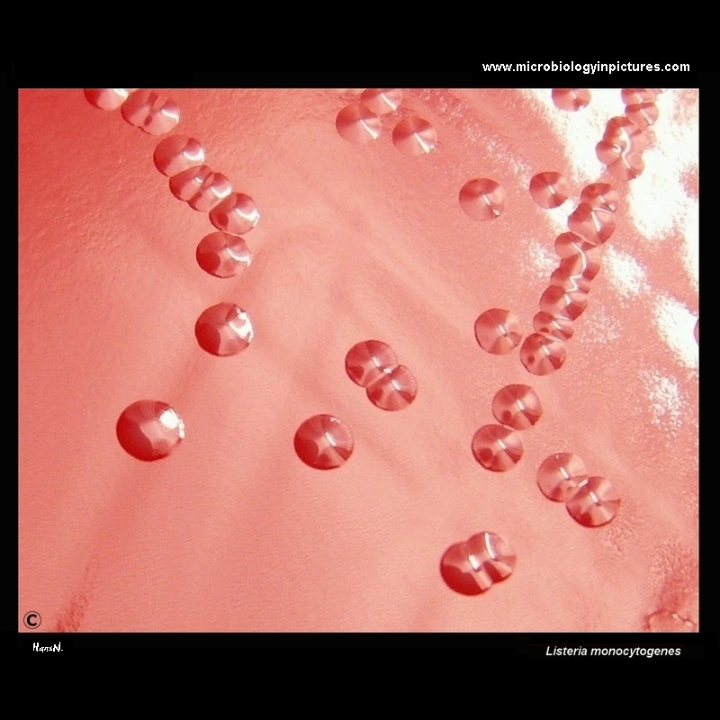 Listeria monocytogenes colonies on blood agar