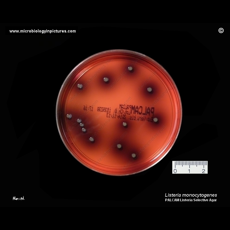Listeria monocytogenes on PALCAM