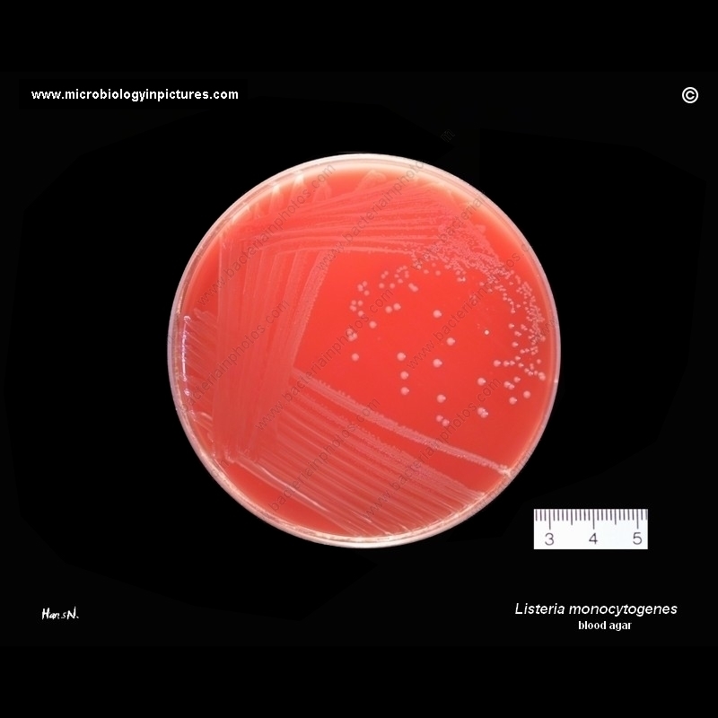 Listeria monocytogenes