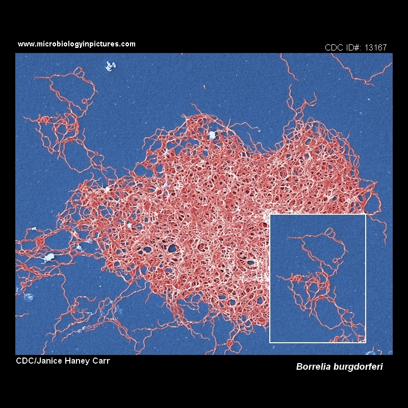 borrelia image