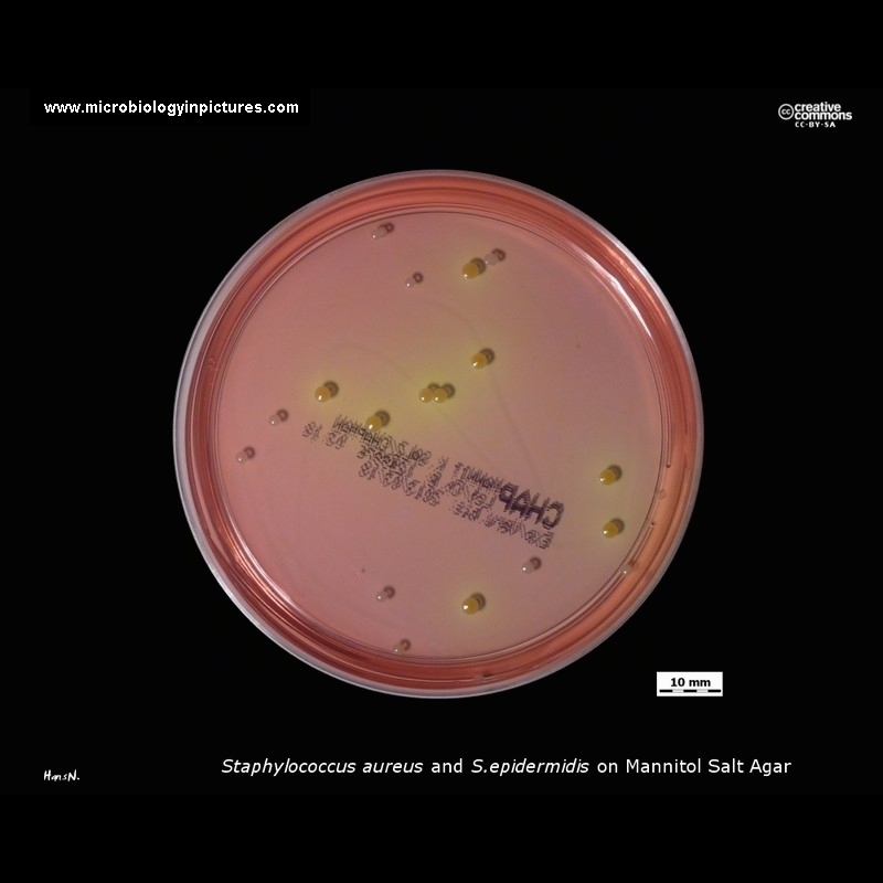 mannitol salt agar