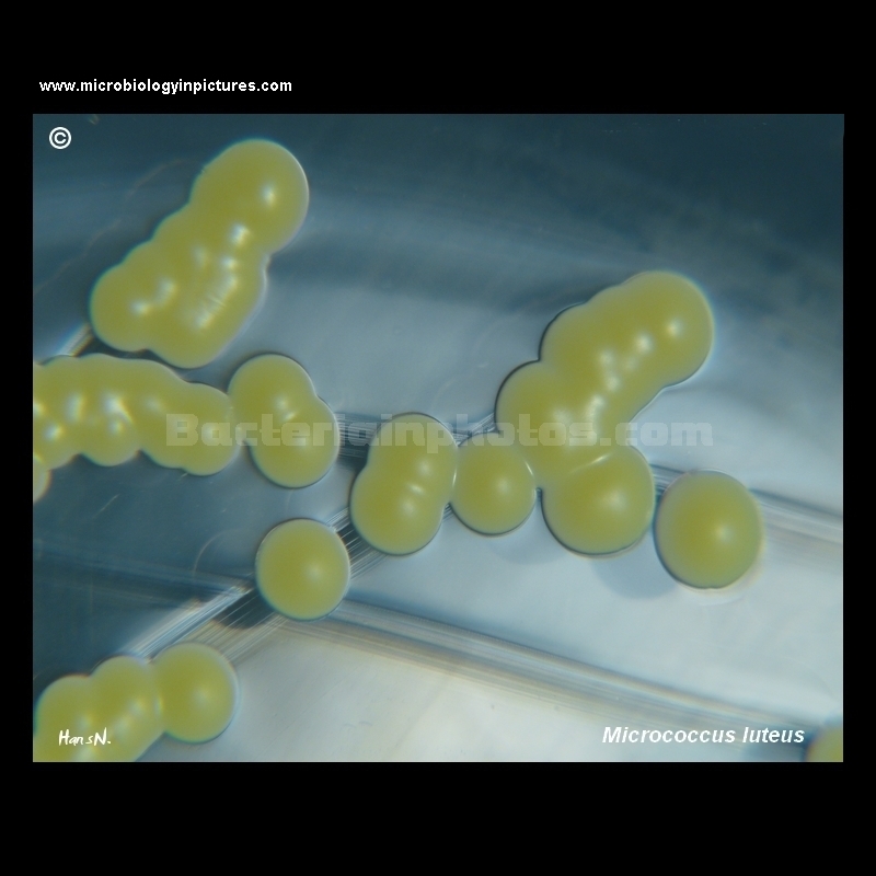 micrococcus luteus on TSA