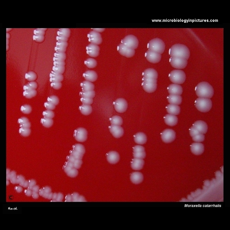 Moraxella catarrhalis colonies on blood agar; Branhamella catarrhalis colonies on blood agar