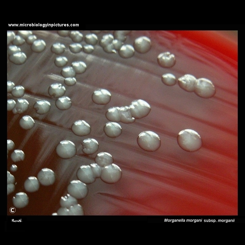 Morganella morganii colonies on blood agar